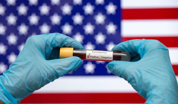 EE.UU. está muy lejos de la cantidad de testeos que aconsejan los expertos. Foto Getty Images
